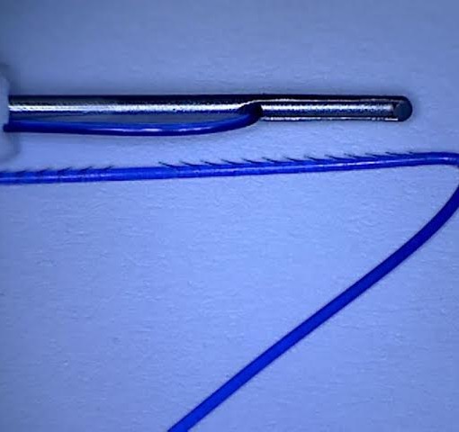 a mezoniti v kanyule yy cog uni 19g150 mm 4 sht 1 up yunex yuzh koreya
