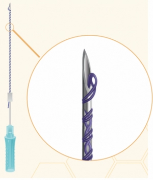 mezoniti spiralnye kosichki double screw 26g x 50 10 sht upk honey derma thread yuzhnaya koreya